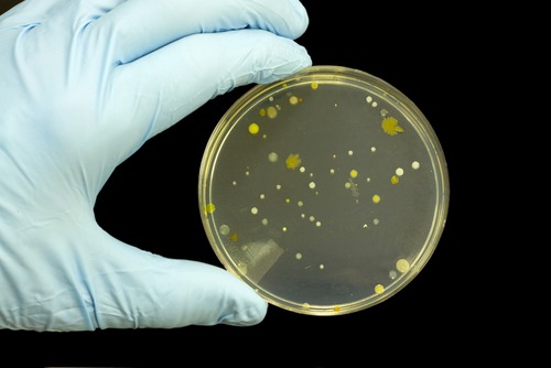 DIY bacteria test